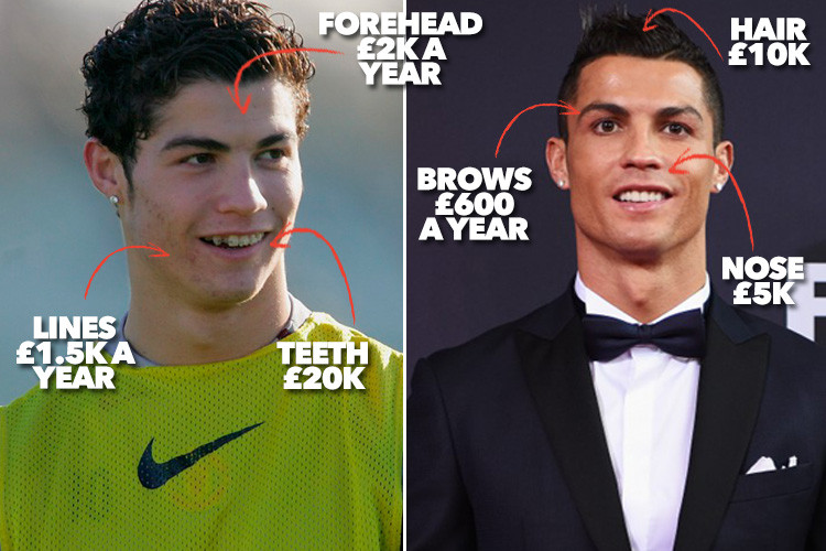 Pakar Kosmetik Tuding Ronaldo Lakukan Bedah Plastik
